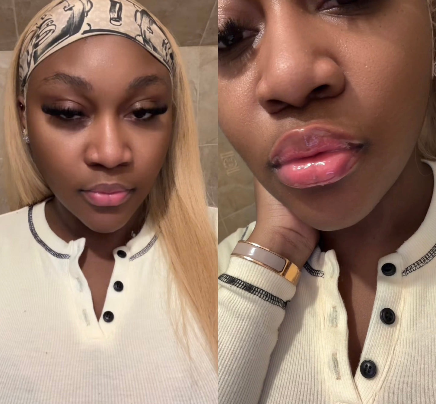 *1/1Intense Lip Plumper aka lip filler