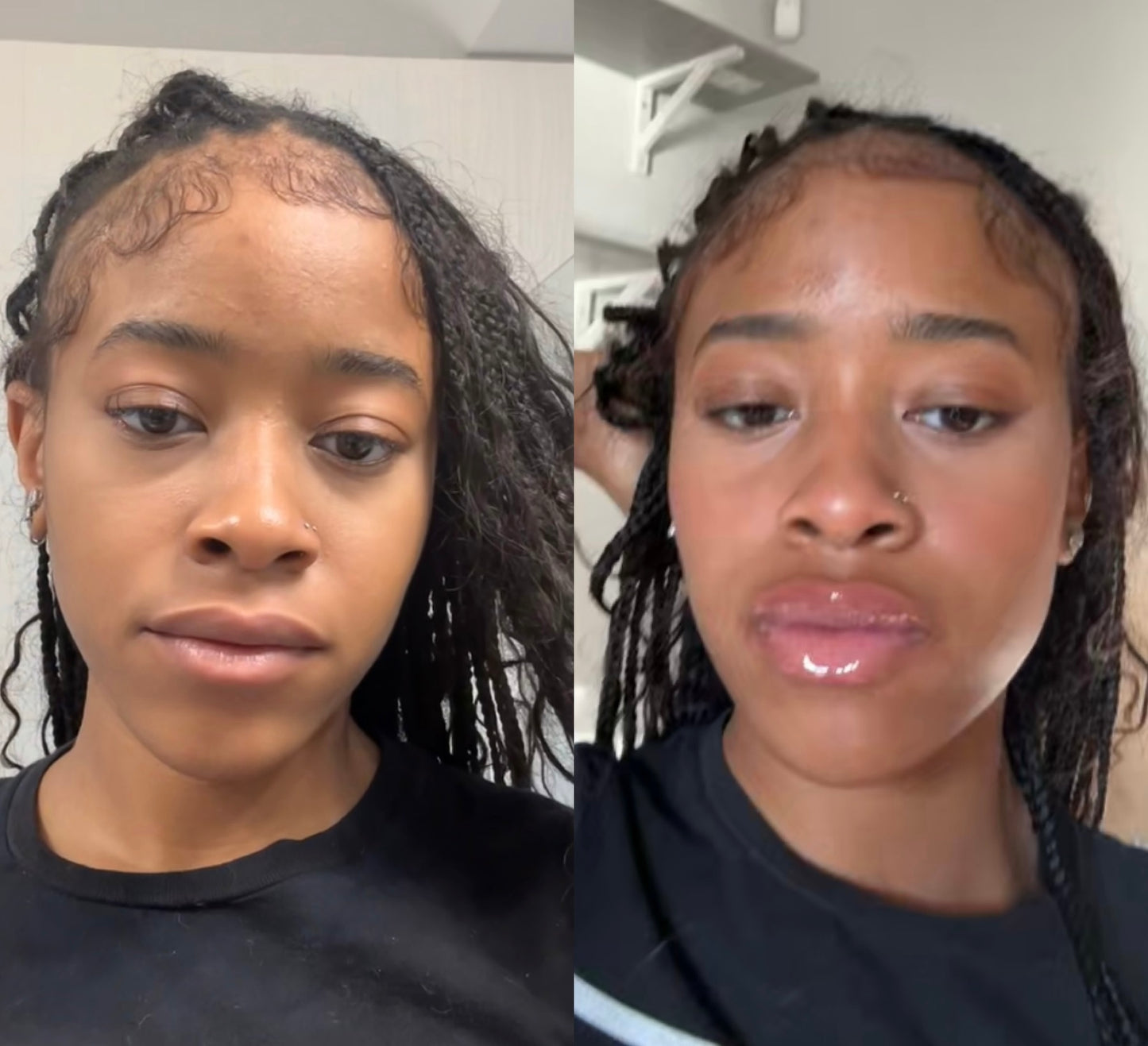 *1/1Intense Lip Plumper aka lip filler