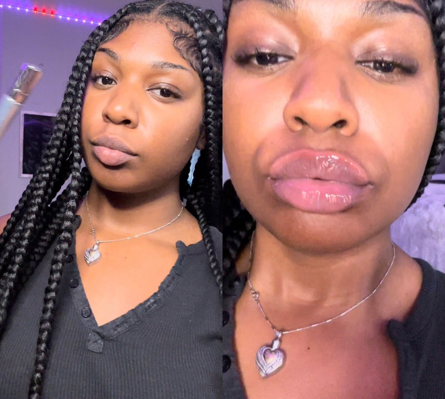 *1/1Intense Lip Plumper aka lip filler